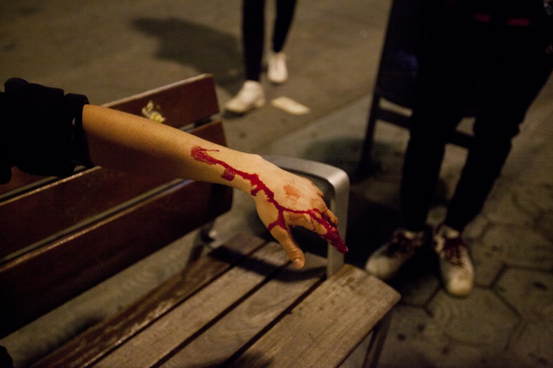 Manifestante herido por las cargas policiales durante las movilizaciones contra la sentencia del juicio del proceso. Cuarta noche consecutiva de disturbios en Barcelona. 17 de octubre de 2019.