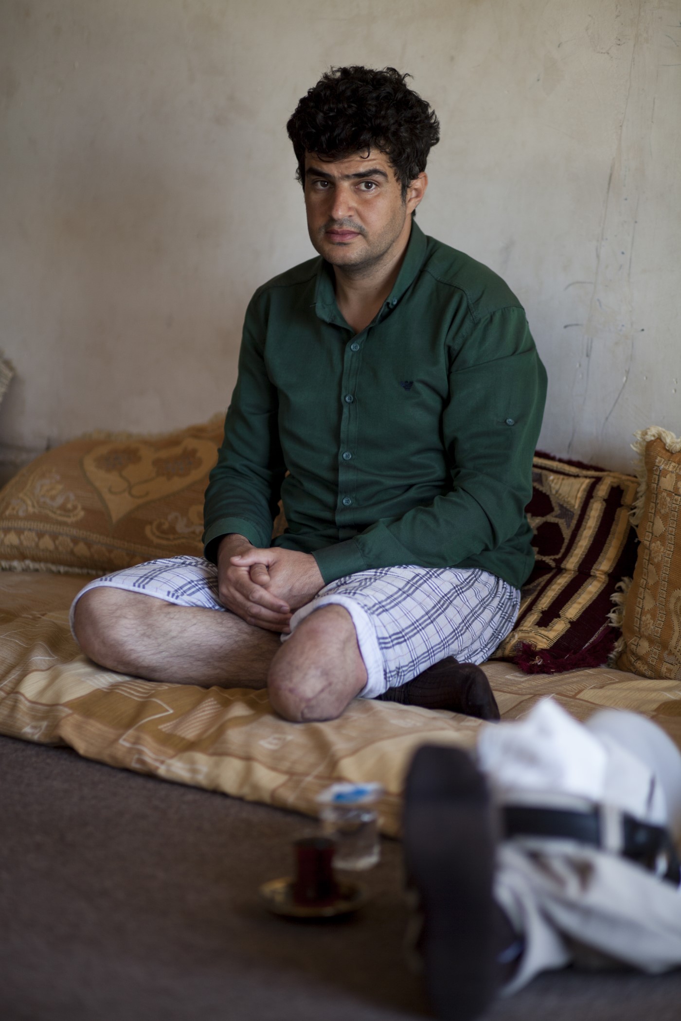 Saman (33), ex Peshmerga i metge, ens mostra la seva cama amputada per l'explosió d'una mina de l’Estat Islàmic mentre tornava de socórrer en una ambulància dos Peshmergas ferits a prop de Mossul l'any 2016. Va ser l'únic supervivent. Pramagran, Kurdistan, Iraq. 14 de maig de 2017